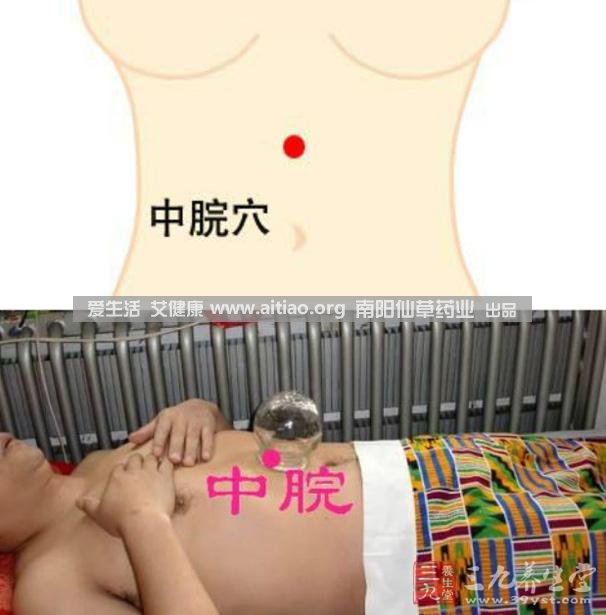 中脘穴位于腹部正中線(xiàn)，臍上4寸的位置上。每天艾灸10-15分鐘，能有效緩解胃部不適的癥狀，同時(shí)有助于祛濕。